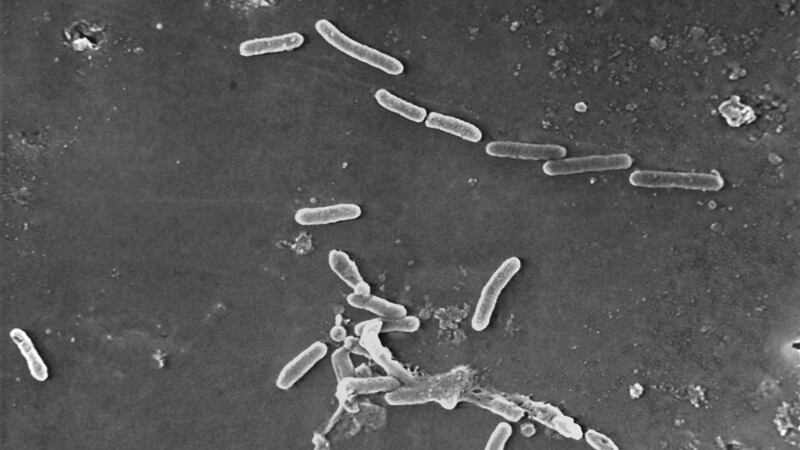 FILE - This scanning electron microscope image made available by the Centers for Disease...
