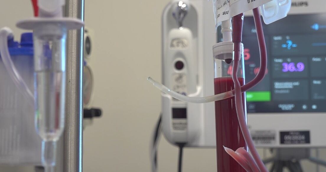 Health Watch: New RRMC infusion center reduces wait times - Vimarsana News